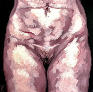 scarred